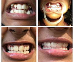 Before and after cases